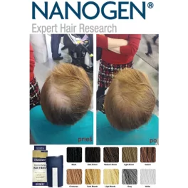 Nanogen Hair Fibres (15g. / 30g.)