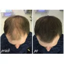 Nanogen Hair Fibres (15g. / 30g.)