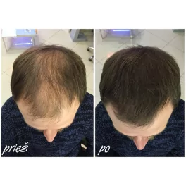 Nanogen Hair Fibres (15g. / 30g.)