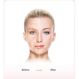 BOMTECH Renouveau Beauty Esthetic Pen