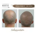 Biotic Phocea Scalp Micropigmentation