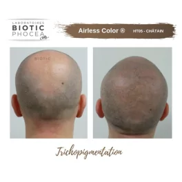 Biotic Phocea Scalp Micropigmentation
