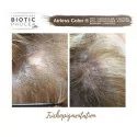 Biotic Phocea Scalp Micropigmentation