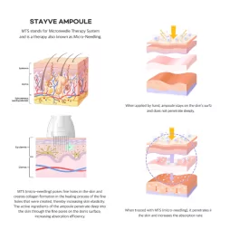 STAYVE Collagen Ampoule (10×8ml)