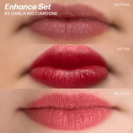 Perma Blend Carla Ricciardone Enhance Set