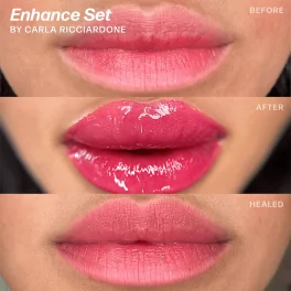 Perma Blend Carla Ricciardone Enhance Set
