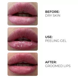 AS COMPANY Pīlinga Gels Ar Aktīvo Skābekli (17ml)